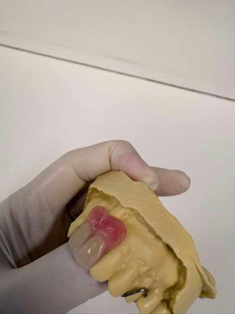 Custom denture samples crafted in Oak Park on-site dental laboratory Melbourne